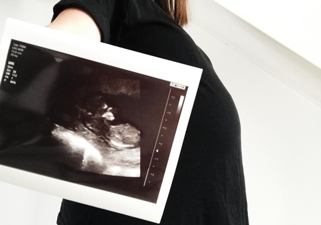 ideefabiek zwanger zwangerschapsaankondiging echo gender reveal baby