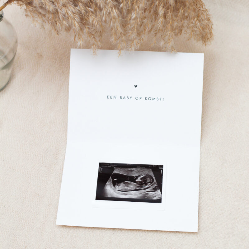 Ideefabriek echofoto zwangerschapsaankondiging onthullingskaart echofoto
